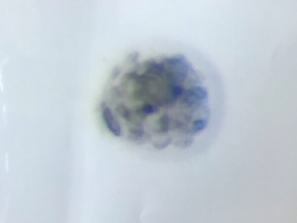 融解した胚盤胞　４BB