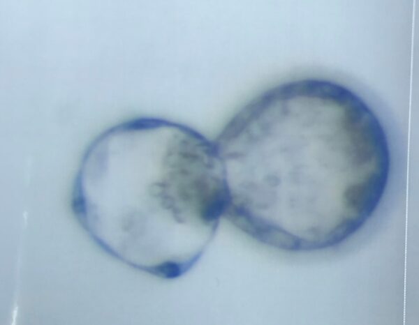 4AA胚移植