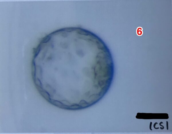 6日目胚盤胞　4BA