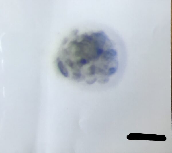 胚盤胞4BB
